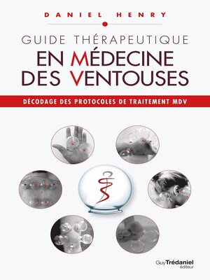 cover image of Guide thérapeutique en médecine des ventouses--Décodage des protocoles de traitement MDV.